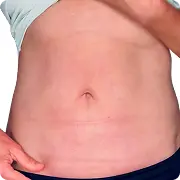 After treatment image of Jm